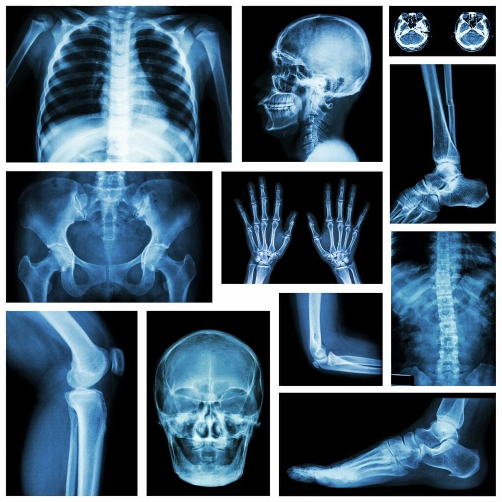 X-ray example of different body parts